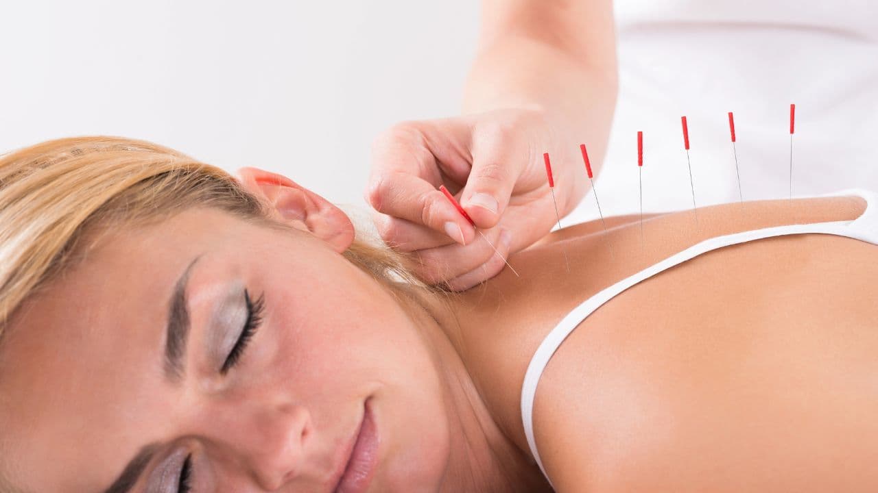 Acupuncture Clinics