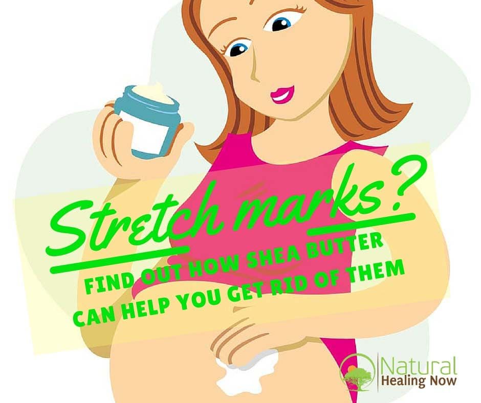 Is Raw Shea Butter For Stretch Marks?